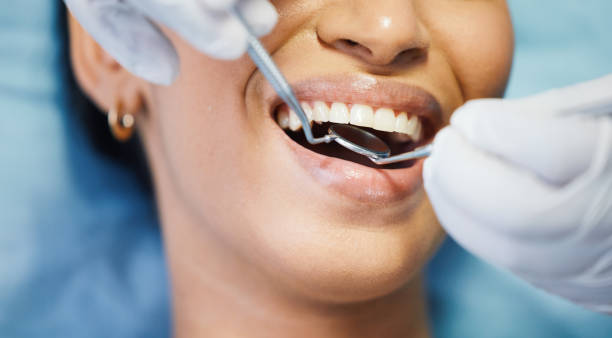 Best Emergency Dental Care for Broken or Chipped Teeth in Decatur, IN